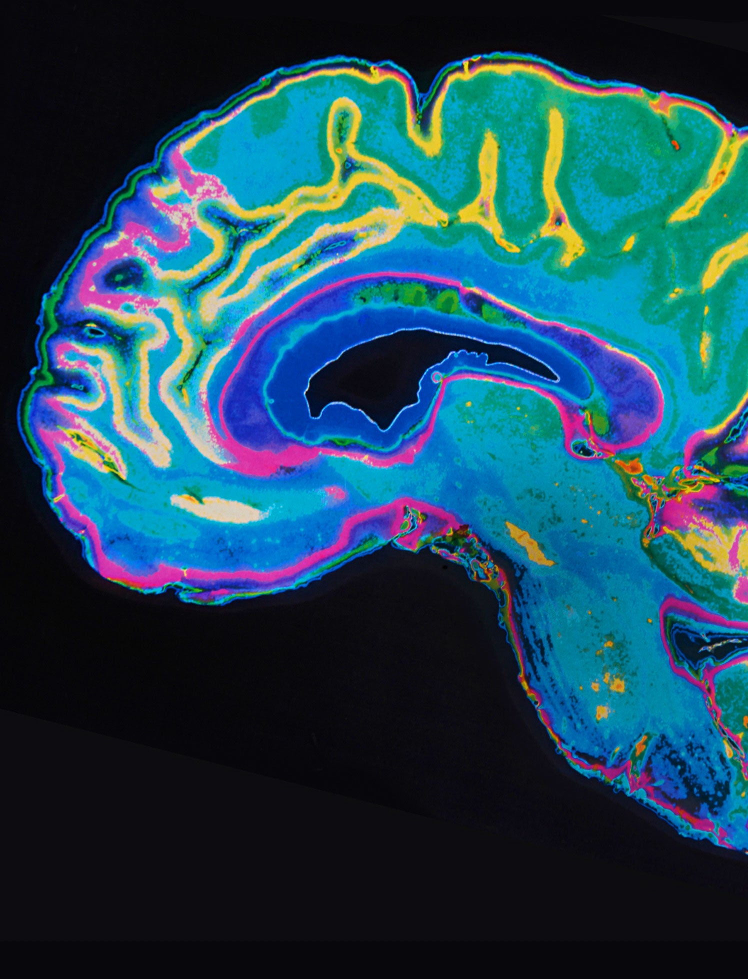 Brain graphic