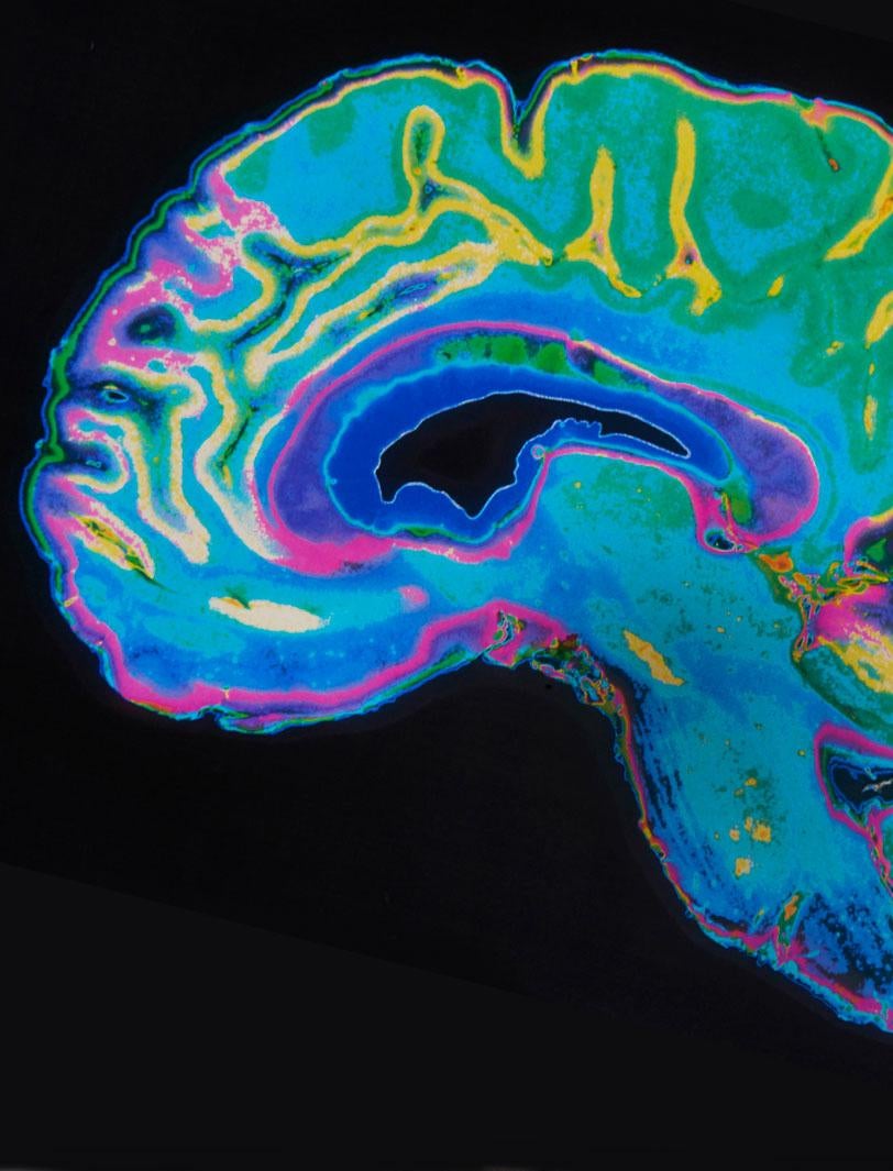Brain graphic