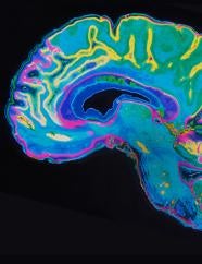 Brain graphic